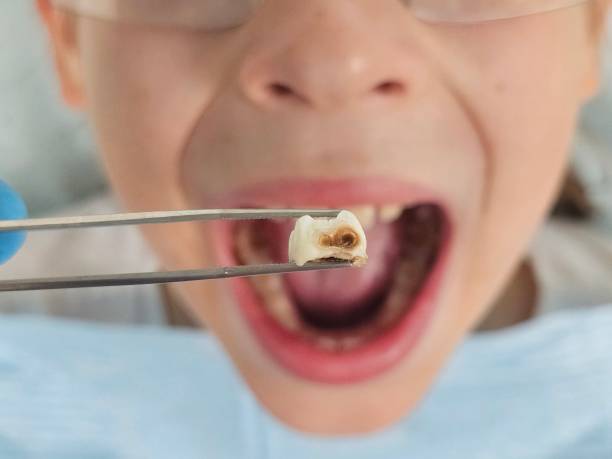 Best Emergency Treatment for Jaw Pain or Injury in Catasauqua, PA